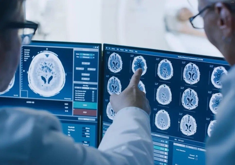 تاثیر ویروس کرونا بر سیستم عصبی_9