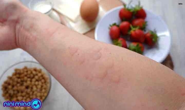 خواص توت فرنگی در اوایل بارداری_7