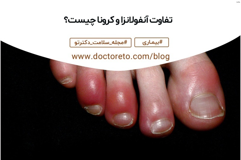 ویروس شبه کرونا چیست_8