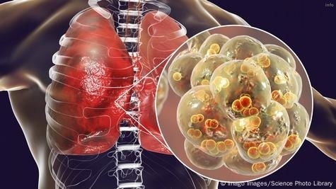 ویروس کرونا با بدن چه میکند_8