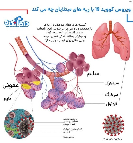 ویروس کرونا برای رسیدن به شش ها از چه اندام هایی گذشته است_4