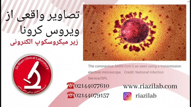 ویروس کرونا زیر میکروسکوپ_9