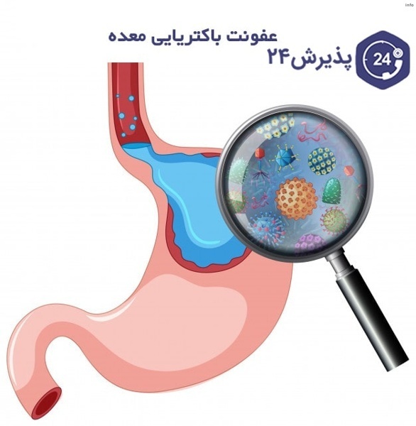 ویروس کرونا و معده درد_6