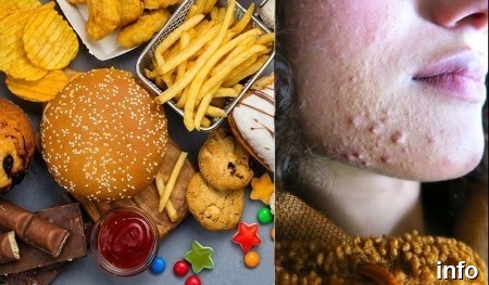 تخمه آفتابگردان جوش صورت_3
